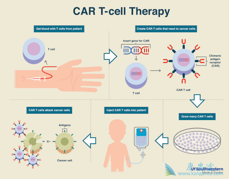 CAR-T