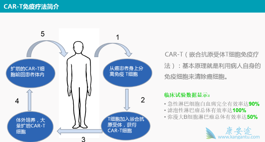 CAR-T