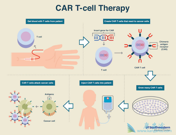 CAR-T