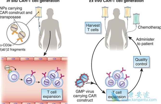 CAR-T