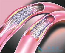 ����ҽ���ÿɽ���֧���û��߸��Ѫ˨