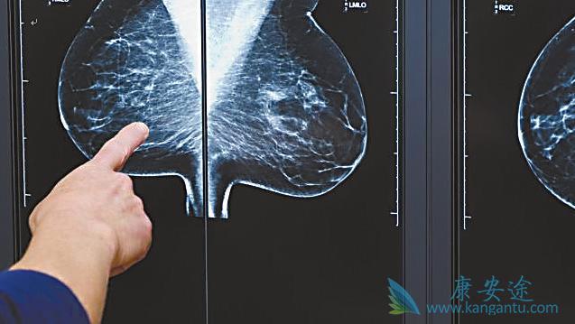 海外医疗 海外医疗