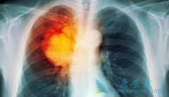 �ΰ�ҩ�￭����/����������ȡ����ѧ������