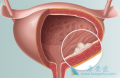 ķ(pembrolizumab)ưװЧΪ29%