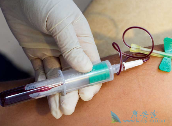 CAR-T细胞治疗 CAR-T细胞治疗