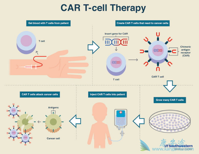 CAR-T