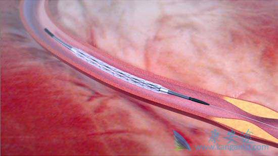 海外医疗 海外医疗