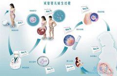 国内试管婴儿和泰国试管婴儿流程对比
