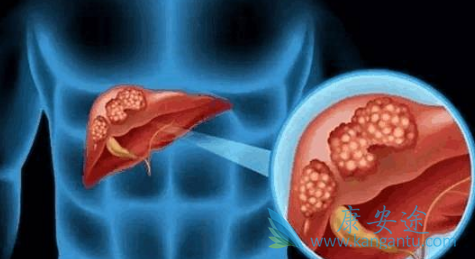 阿西替尼 阿西替尼