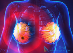 ��ά˾Ⱥ(Faslodex)�����ٰ��ڷ��������еĻ�������ѡ