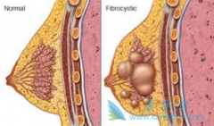 ��������(palbociclib)���������ٰ�ҩ����Эͬ����