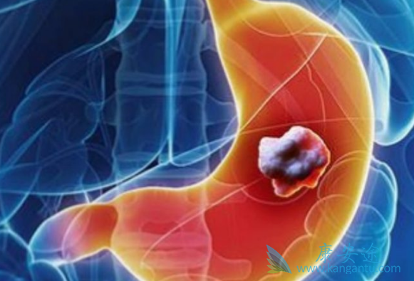 ��Ī«����