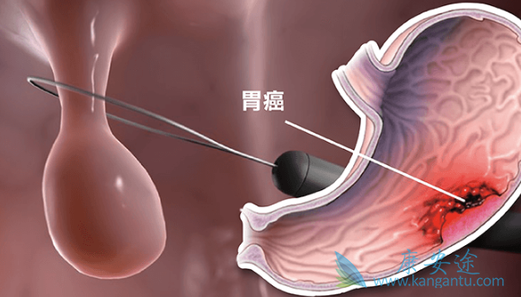 ��Ī¬����