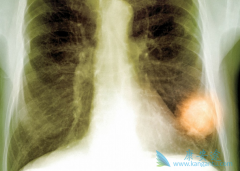 Osicent���ϼ���Incepta��˾���Ƶ�ƿװ��ϣ����