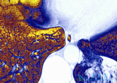 Ϊʲô̩��ɯ(AZD9291)������PD-1ҩ������ʹ��