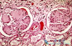 ��άĪ˾(EVERTOR)�ҹ��Ƽ���TSC-AMLһ�����Ʒ���