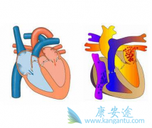 ����̹(Bosentan)���µ���Һ������ʲô֢״����