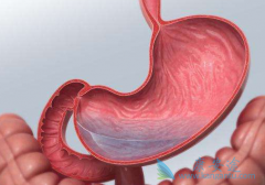 ��������(Olaparib)������ɼ������Ϊθ�����ߵ�һ���Ʒ���