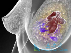 �ٴ������Ԥ��̩�˲�/�������������Ч��