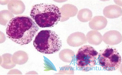 ���ǶȰ�/�����׵ÿ�ʹ�෢�Թ��������ߵĴ��ʱ��ﵽ3������