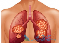 ������ҩ�ܼ��Ἢ������(GEFITINIB)�ĸ�������