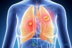 ��������/�������µ�ת��ø����ͨ��������ʲôʱ��