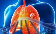 �ΰ�����֮�����Ʒ��ͻ�ѧ�Ʒ��Ľ���