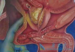 �ٴ������󳣼���ǰ���ٰ�֢״��ʲô