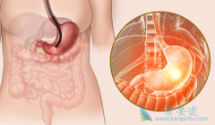 ��������(Apatinib)����S-1�ɽ�һ���������θ�����ߵ�DCR