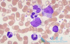 ��Ѫ�������ڼ����Ż��֢״ʱ��ʳ����ô����