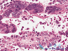 Ϊʲô����ҩ����������Ҳ����������֯����