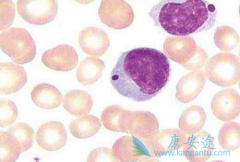 ��³����(IBRUTINIB)��ʹMZL���ߵ���λ�޽�չ�����ڴﵽ14.2����