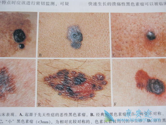 ��ɫ����