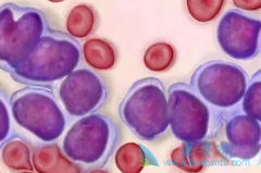 ���������쳣�ۺ�֢����Ӧ��η��������׵�(lenalidomide)