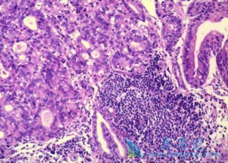 ��ɳ����