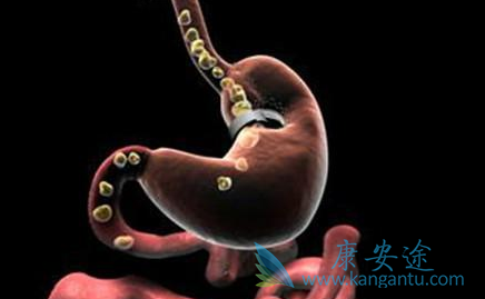 ��Ī«����