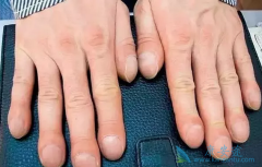 ������״ָ�Ƿ���Ƿΰ�����״ָ��ʲô��