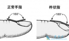 �ΰ���֢״������״ָ֮�⻹����Щ��