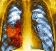 �����鵥��/̩�������Ϸ��ƿ��������Ʒΰ���ת�ƻ���