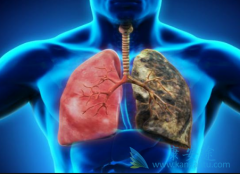 RET���Ƽ�LOXO-292�����������������ͷ�Сϸ���ΰ�ͻ�����Ʒ�