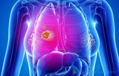 ��������ʱ�ɰ�ÿ��һƬ�����޿�/���������Ϊ��Ƭ