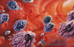 ΪʲôNICE���Ƽ���������ʹ�����������������������԰�Ѫ��