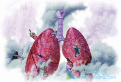 ��������(AFATINIB)���һ��EGFR-TKIs���������˻��ߵ�PFS