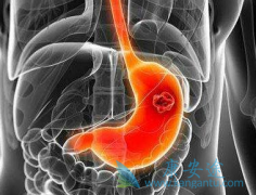 ����ҩ���������(Olaparib)������������θ����