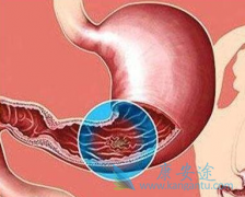 θ������������������Ҫ���ڷ��ø�����(Imatinib)��