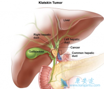 EGFRҲ�ǵ������бȽϳ��������ưе�