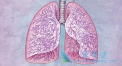 PD-L1���尢���쵥��ע��Һ(atezolizumab)�����Ʒ�Сϸ���ΰ���