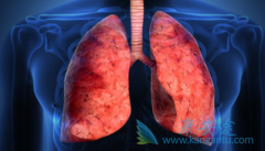 ALK���Ƽ���������(Alunbrig)�򽫳�Ϊ���Ĵ�EGFR���Ƽ�