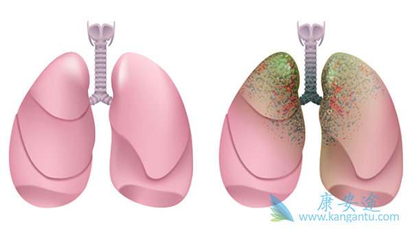 艾乐替尼 艾乐替尼