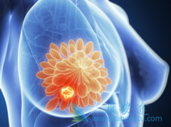 T-DM1(Ado-trastuzumab)�������鵥�����߰�ȫ��